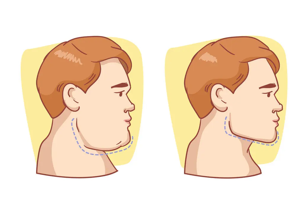 Best Jawline Exercises For a Defined and Attractive Face