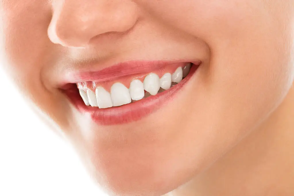 How to Make Your Teeth Whiter Naturally?